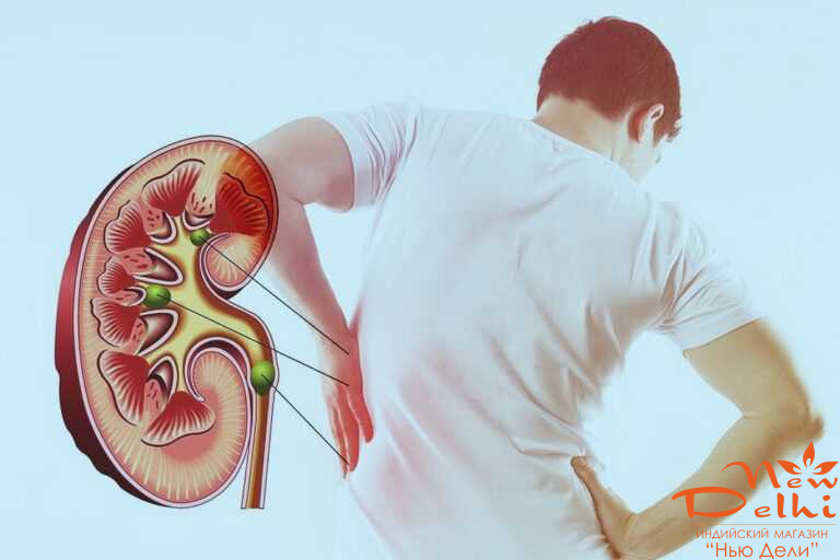 Калкурі  Чарак , 60 табл. Для здоров'я нирок та сечовивідних шляхів. Індія.